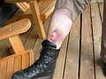 Tough leg - the monster bruise